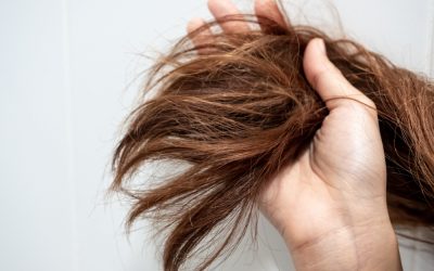 ¿Cómo saber si la pérdida del cabello es genética o estrés?